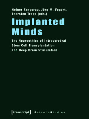 cover image of Implanted Minds